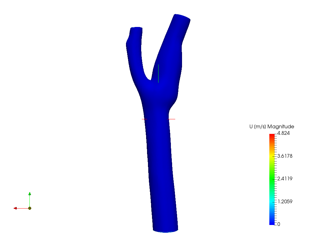 Carotid blood vessel simulation image
