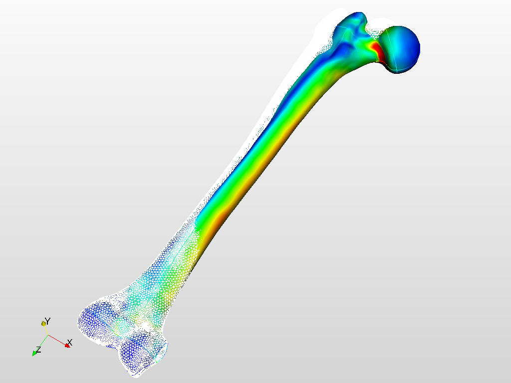 Static stress analysis of the femur image