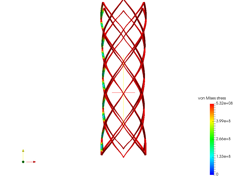 cardiovascular_stent image