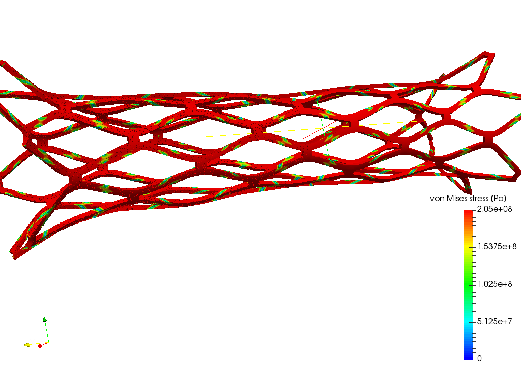 Cardiovascular stent image