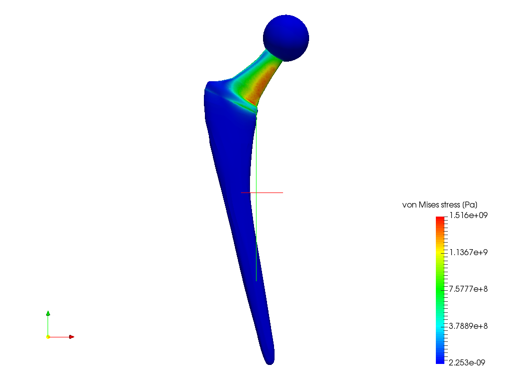 ensamble protesis-hueso.MODELO 1.7.SOLIDO R11.5 image