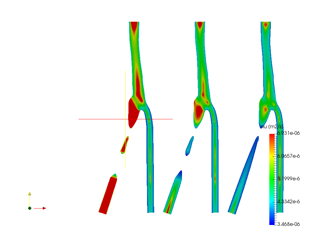 Blood flow in a Carotid Artery Bifurcation - Homework image