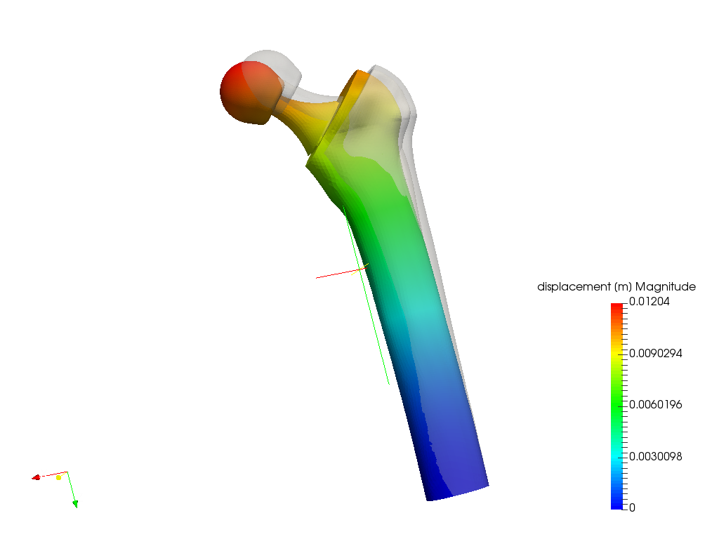 Biomechanics hip joint prosthesis image