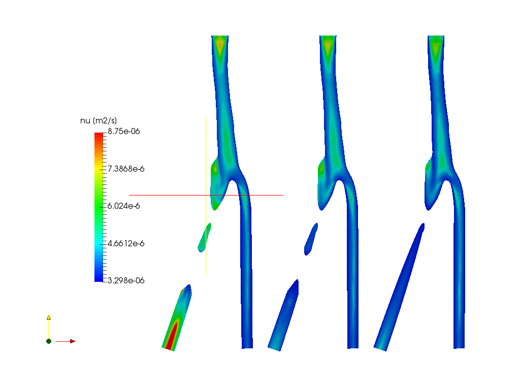 Blood flow in a Carotid Artery Bifurcation - Homework image