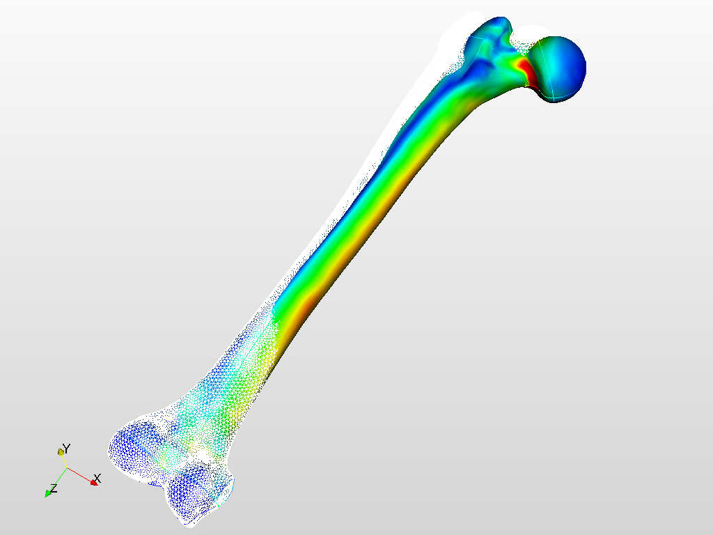 Femur bone stress analysis image