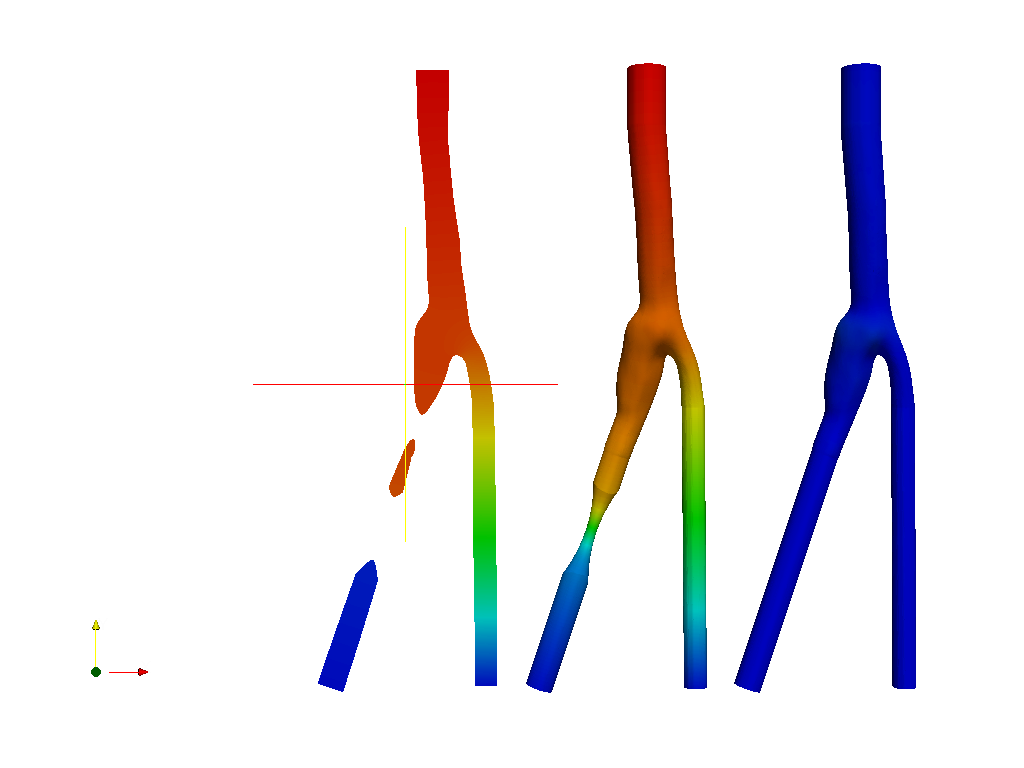 Blood flow in a Carotid Artery Bifurcation - Homework image