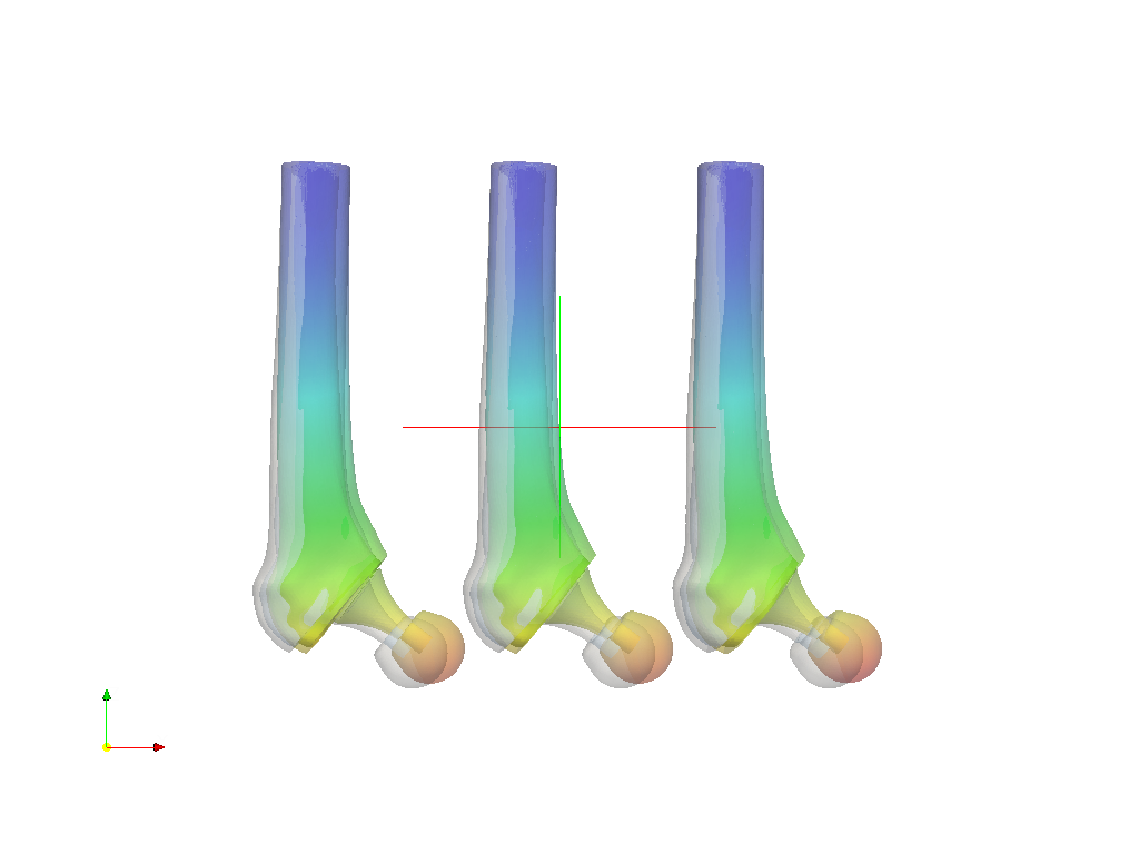 Hip joint prosthesis / Kevser Banu Kose image