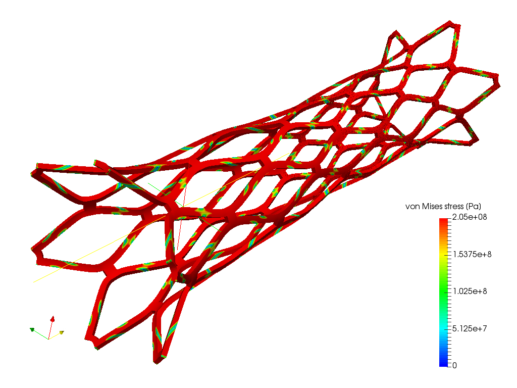 comparison stent image