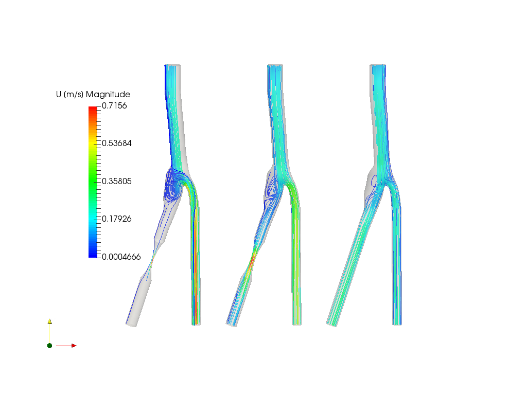 Blood flow in a Carotid Artery Bifurcation - Project Sim image