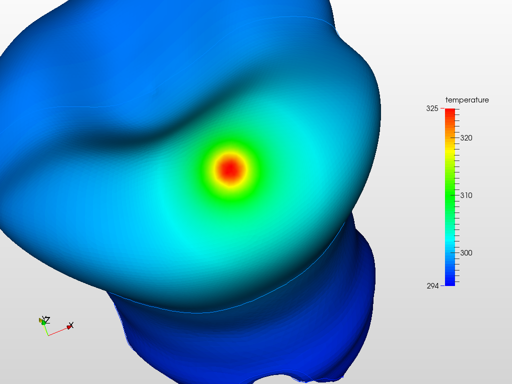Laser Impact on Tooth - Thermal Analysis 2 image