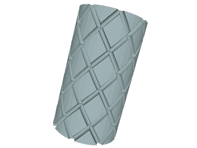 Stent1  Coarseness 3 image