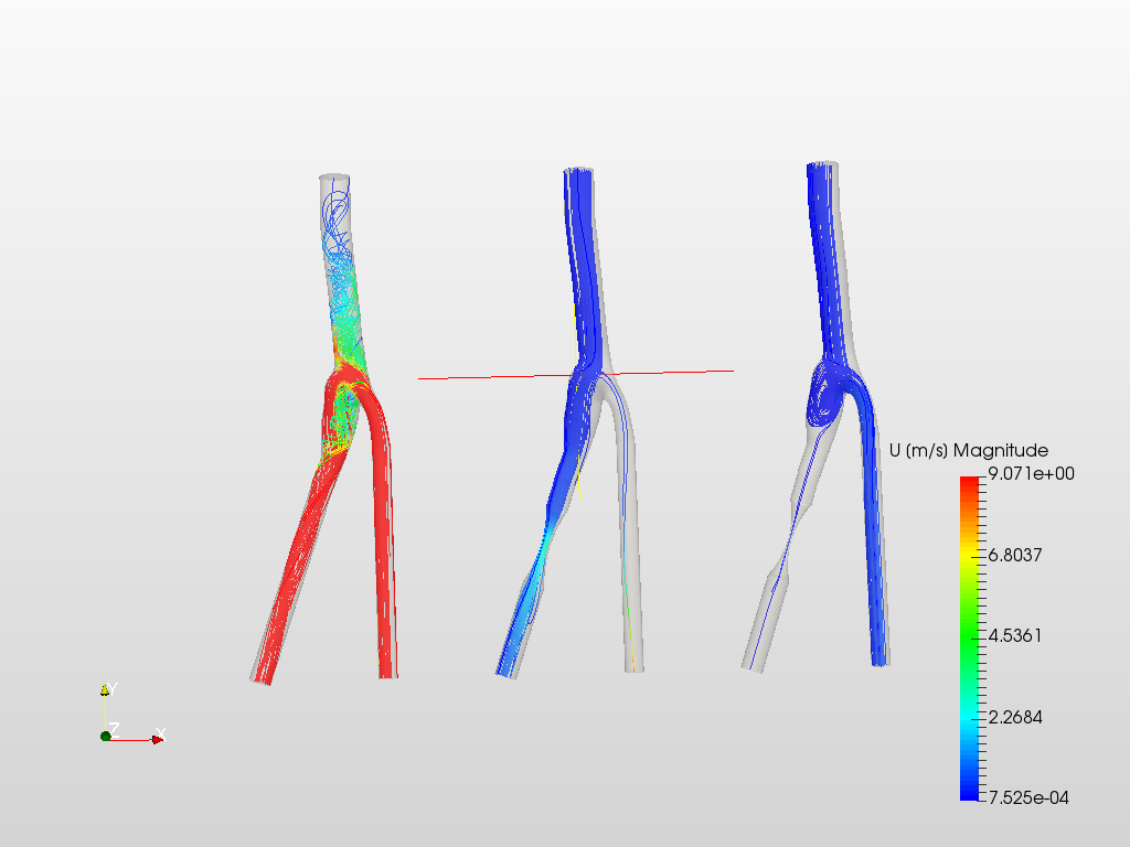 Carotid Artery Bifurcation - Homework image