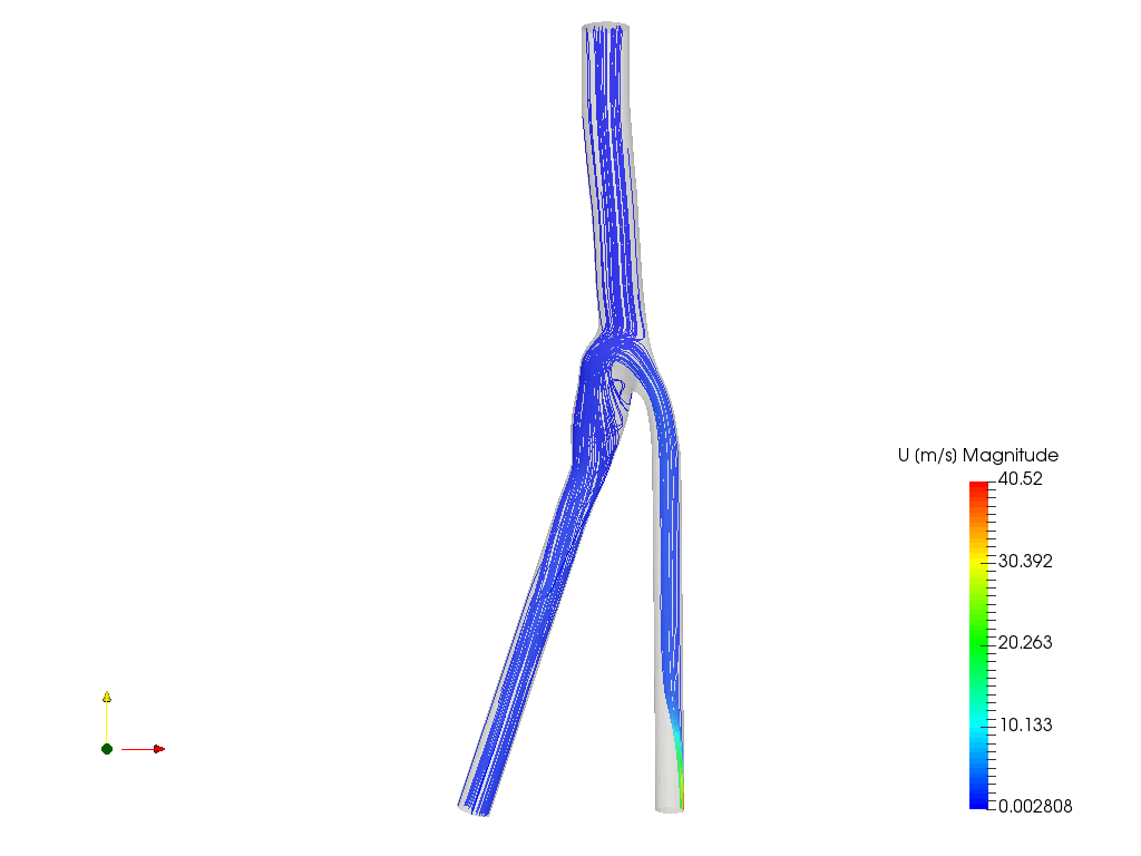 Artery Blood Flow image