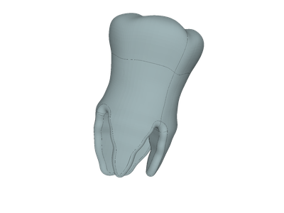 realproject tooth image