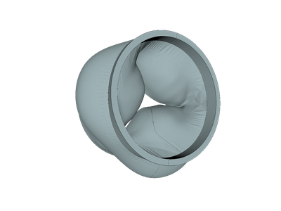 Aortic Valve - FSI image