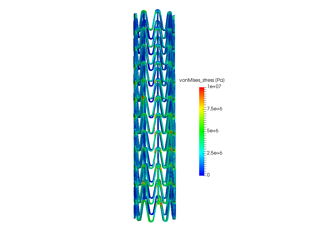 Stent image