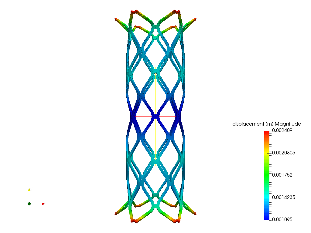 Cardiovascular stent image