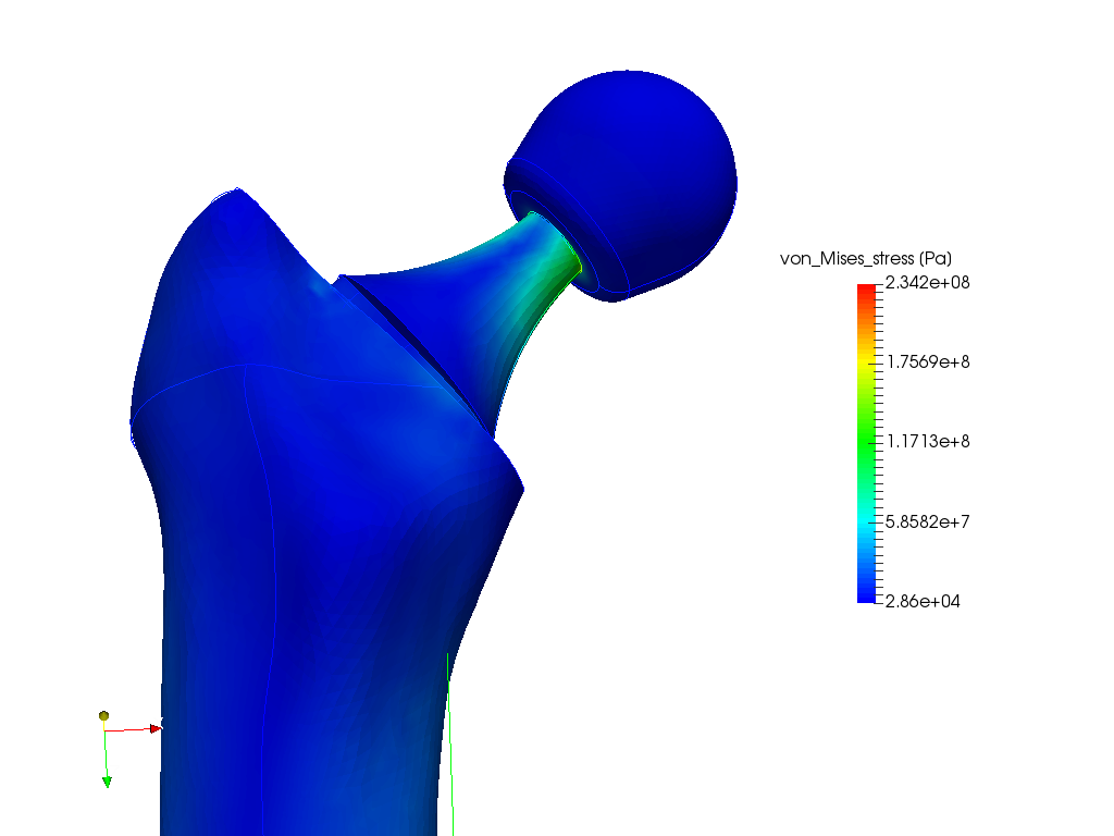Hip Joint Prosthesis - Test of Different Materials image