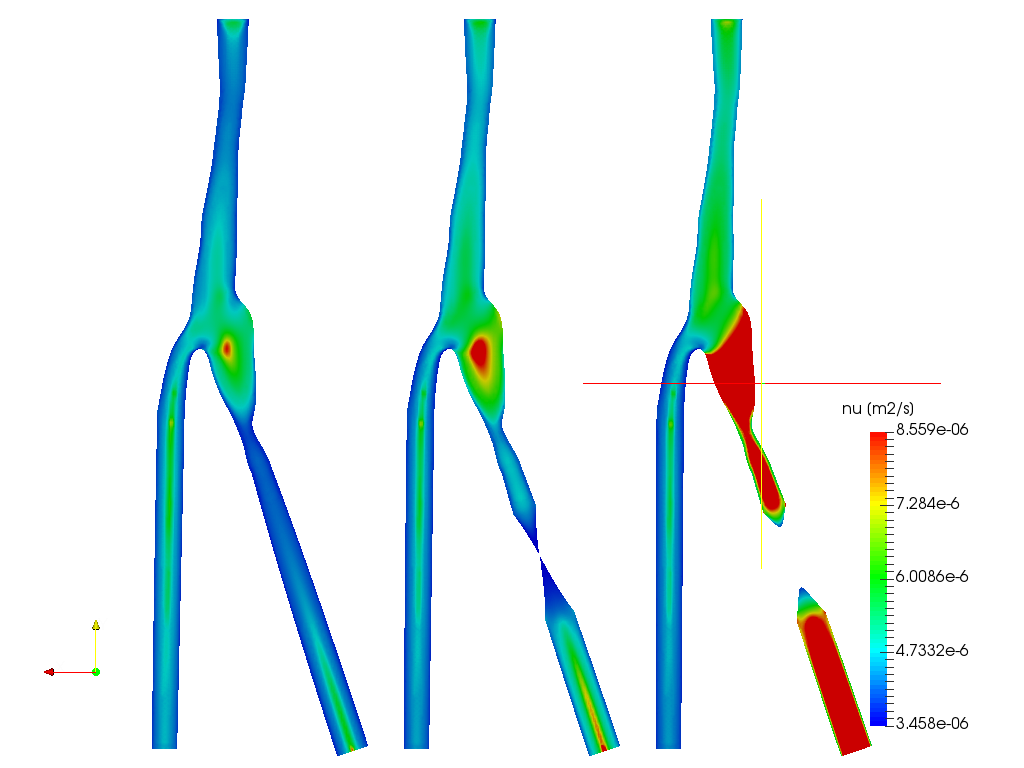 Blood Flow Simulation - Sayeesh image