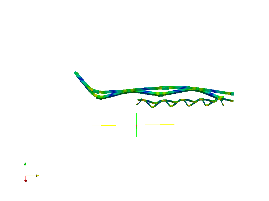 Cardiovascular stent image