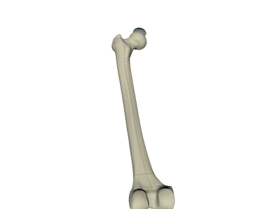 Femur with force cap image