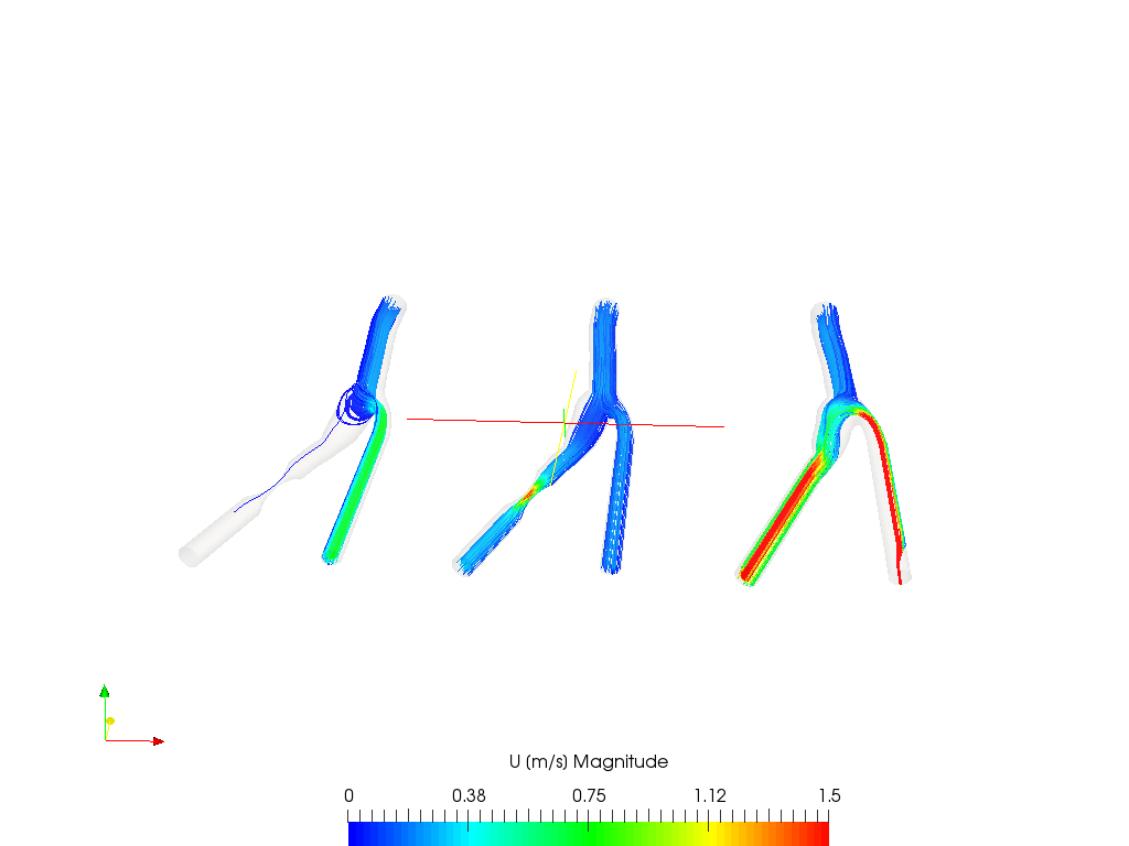 Blood flow in a Carotid Artery Bifurcation - Homework image