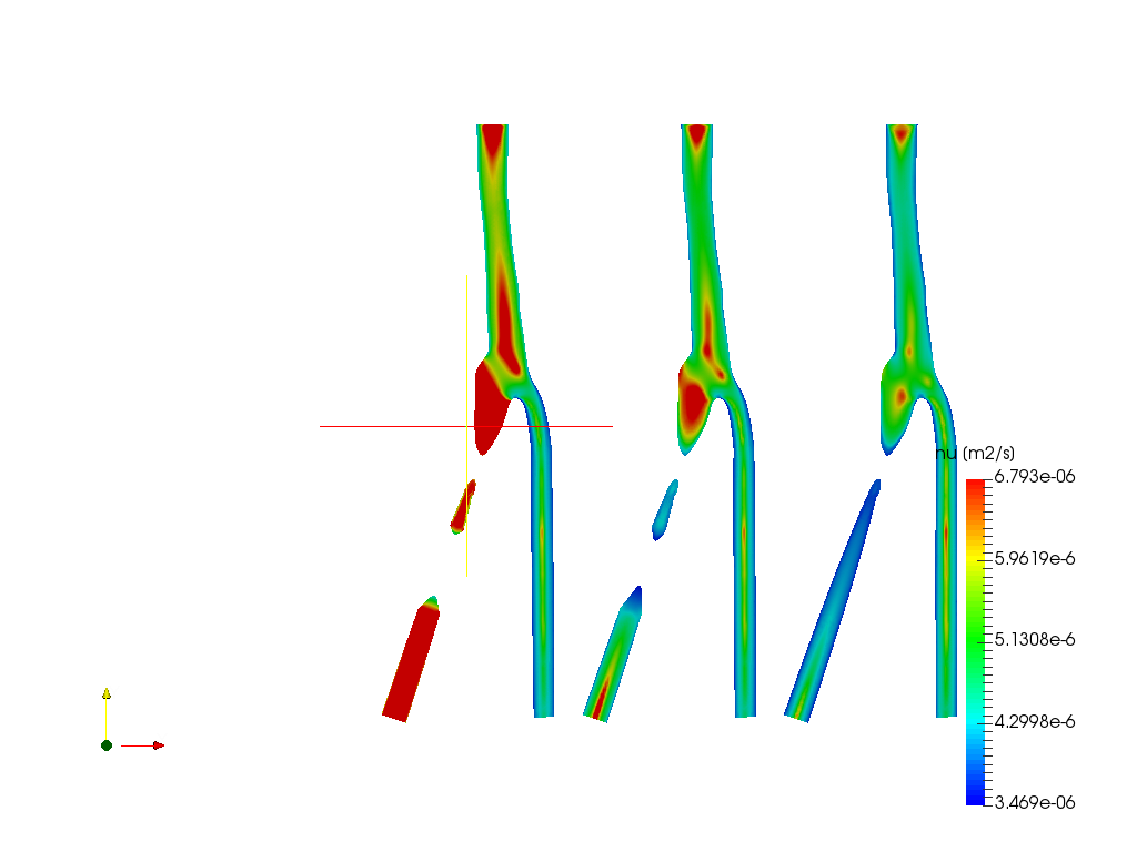 blood flow in carotid artery bifurcation image