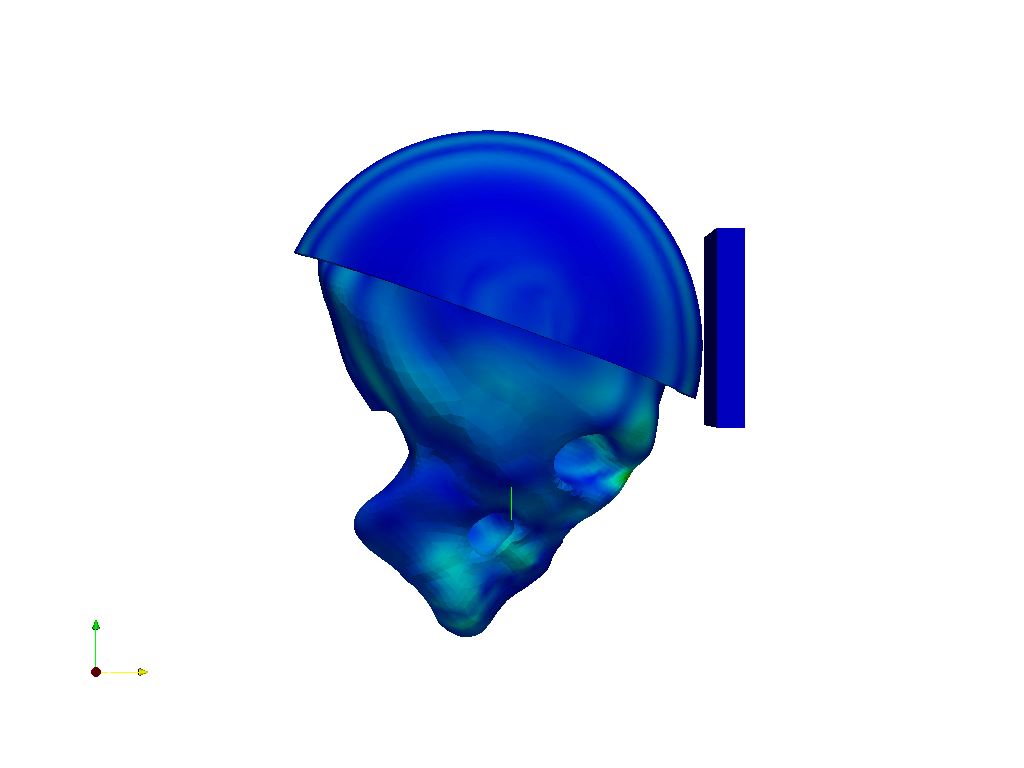 Dynamic Nonlinear Impact Analysis of Skull with and without Helmet image